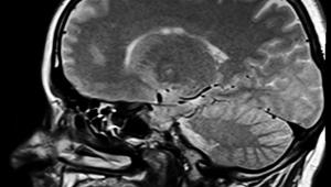 Pensar que la mente humana es una "caja negra" de la que sabemos poco