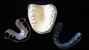 ¿Prevenir la salud dental de mis hijos mediante un tratamiento de ortodoncia?