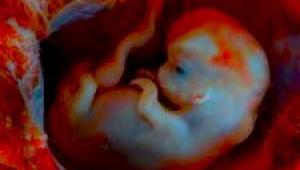 FotografÃ­a de un feto en el interior del cuerpo de su madrw