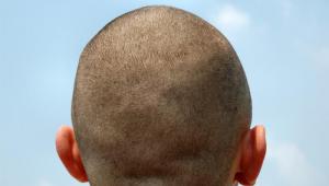 tener-resentimientos-hacia-otros-colectivos-étnicos